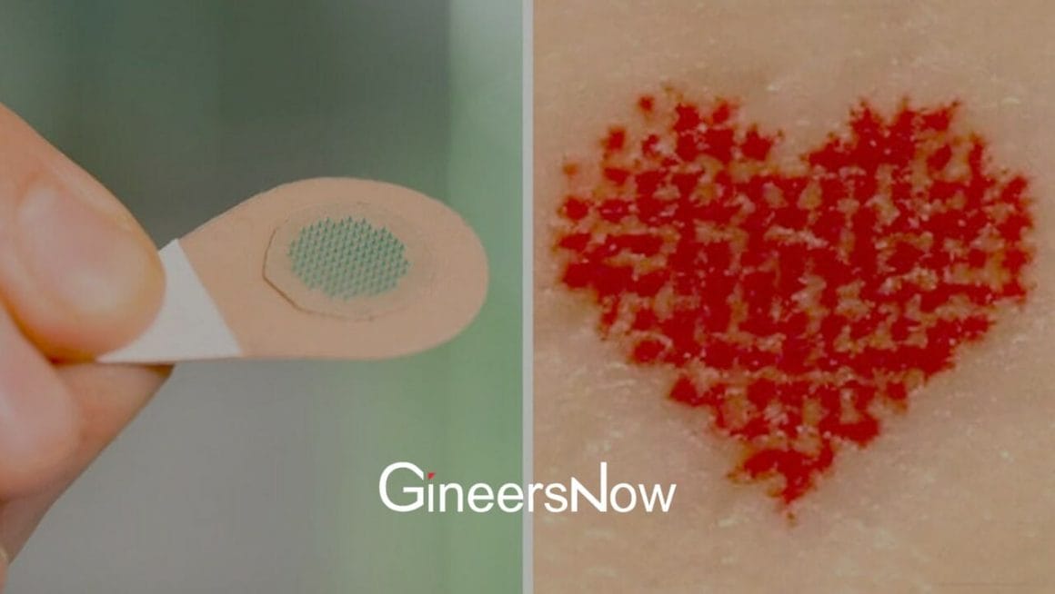 Microneedle Patch Tattoos From The Georgia Institute Of Technology, Mark Prausnitz - GineersNow 
